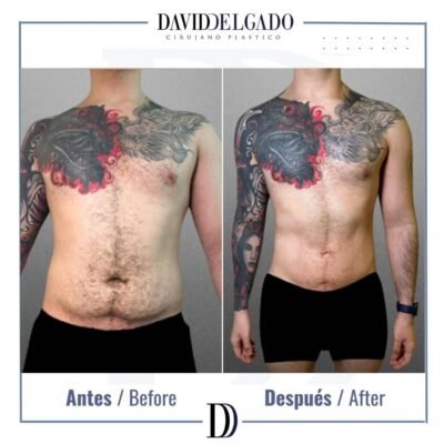 Marcación abdominal hombre fotos