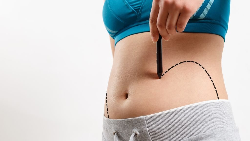 Sculpt Your Sides: Dr. David Delgado’s Expertise in love handles surgery – Flank Liposuction