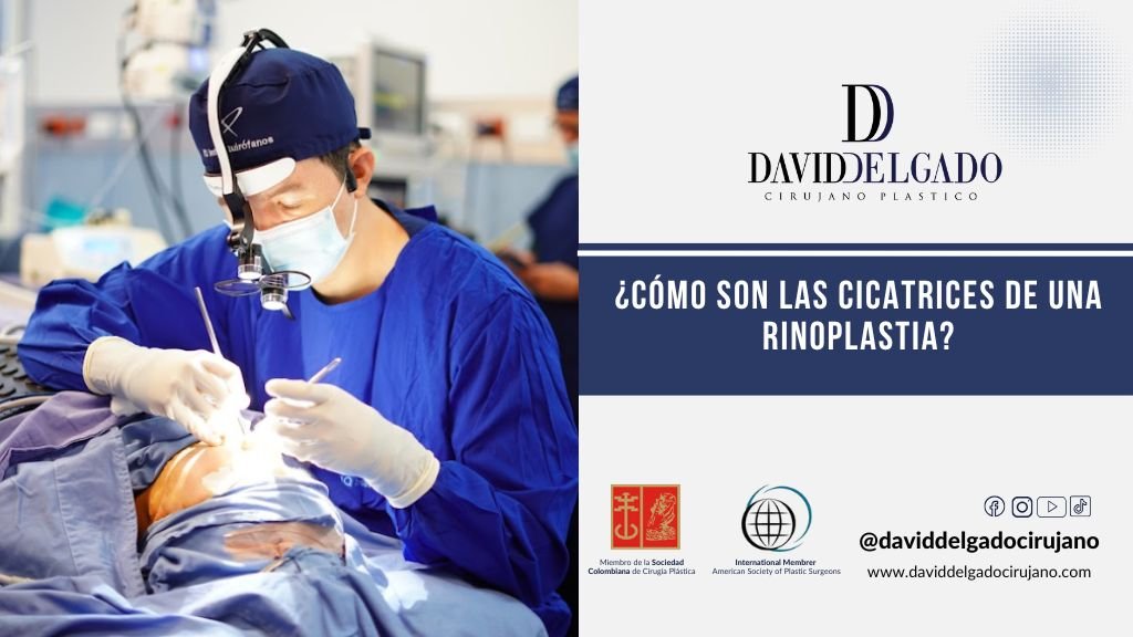 Rinoplastia cicatriz David Delgado