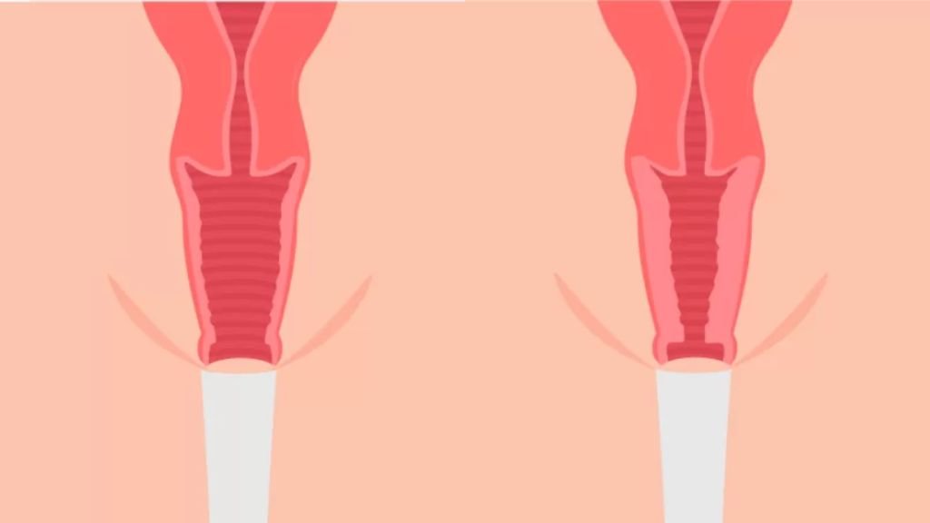 Vaginoplastia y rejuvenecimiento vaginal sin tabúes