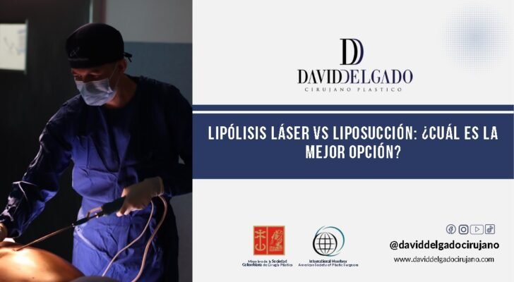 Lipólisis láser vs liposucción: ¿Cuál es la mejor opción?- Dr. David Delgado- Cirujano plástico Medellín