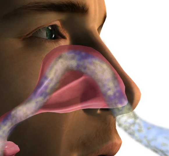 Reducción de cornetes nasales con rinoplastia - Dr. David Delgado - Cirujano plástico en Medellín, Colombia