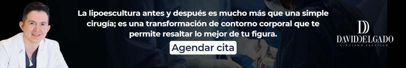 Lipoescultura antes y después- Dr. David Delgado