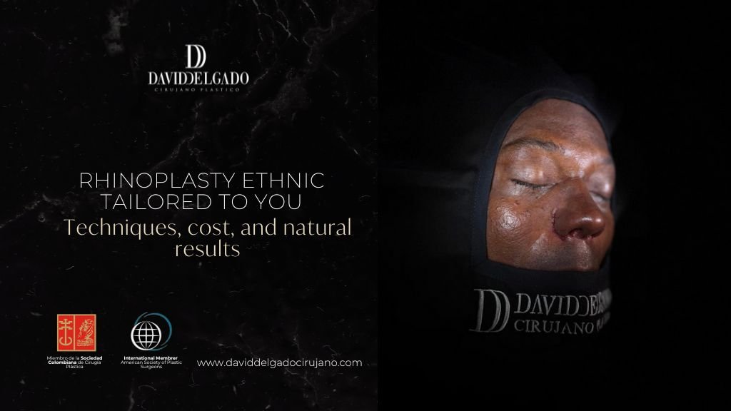 Dr. David Delgado talks about ethnic rhinoplasty - Plastic surgeon in Colombia
