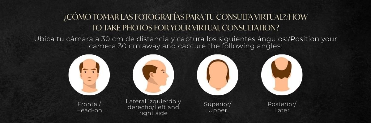 Cómo tomar la fotografía para una consulta virtual de Implante Capilar