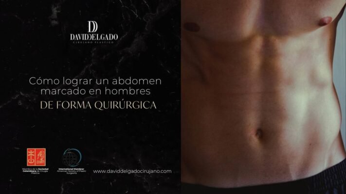 Cómo marcar el abdomen en hombres - Cirugía plástica en Medellín con el Dr. David Delgado