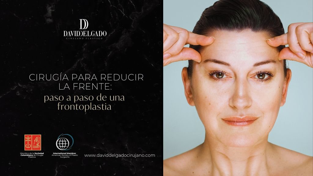 Cómo se hace la frontoplastia paso a paso - Cirujano plástico de Medellín David Delgado