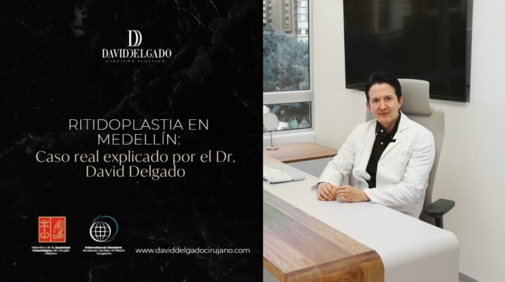 Ritidoplastia en Medellín-Dr. David Delgado