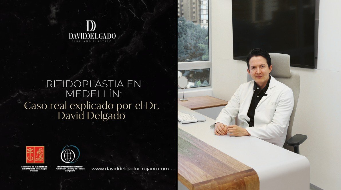 Ritidoplastia en Medellín-Dr. David Delgado