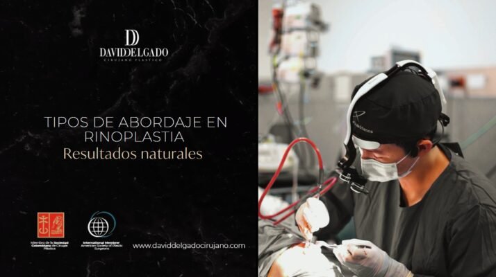 Tipos de abordaje en rinoplastia- Dr. David Delgado