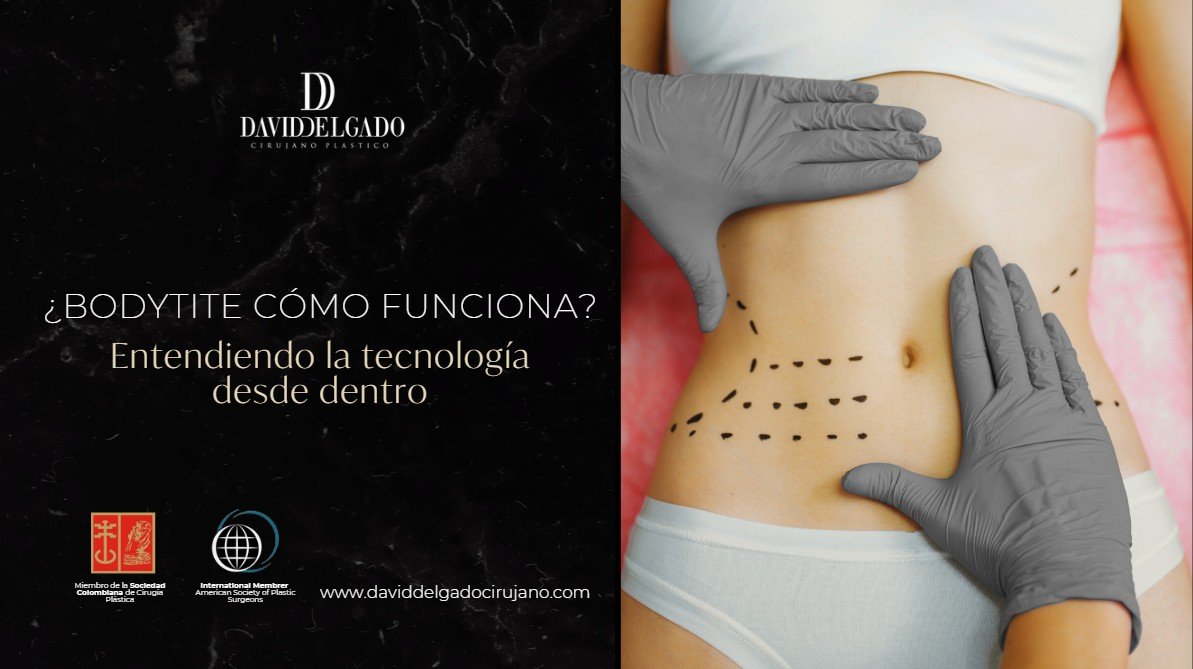 Bodytite cómo funciona-Dr. David Delgado