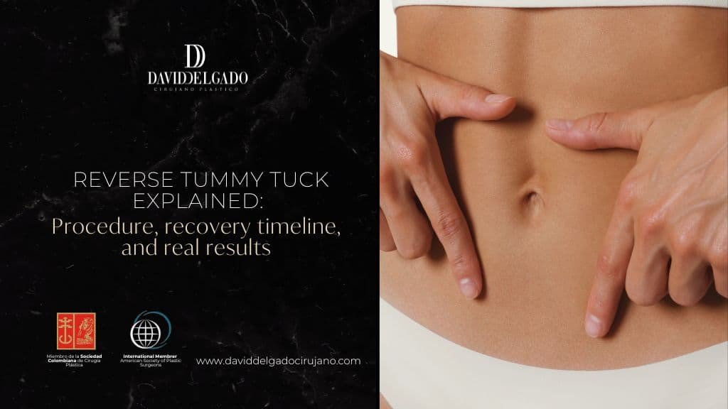 Reverse tummy tuck in Colombia with Dr. David Delgado