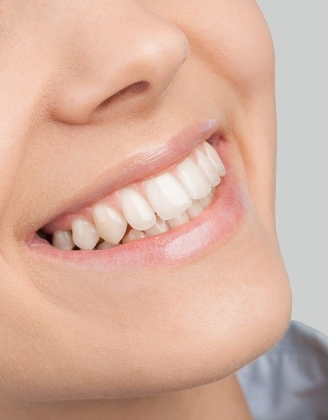 Diseño de Sonrisa en Medellín - Be Dharma Dental - Dr. David Delgado