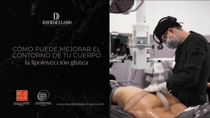 Lipoinyección glútea en Medellín, Colombia, con el Dr. David Delgado 2