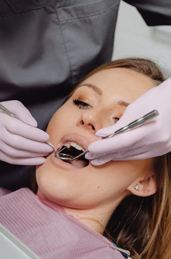 Detrartraje en Medellín - Be Dharma Dental 2