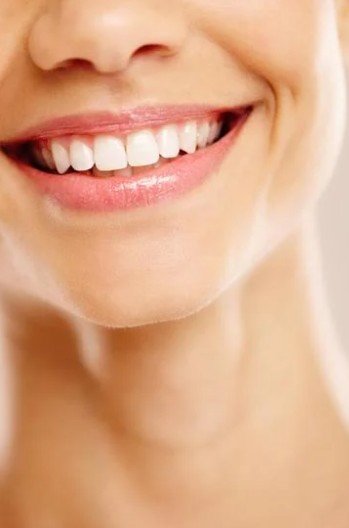 Diseño de sonrisa en Medellín - Be Dharma Dental 2