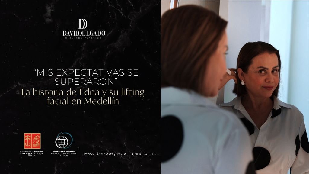 Lifting facial antes y después en Medellín - Cirujano plástico David Delgado