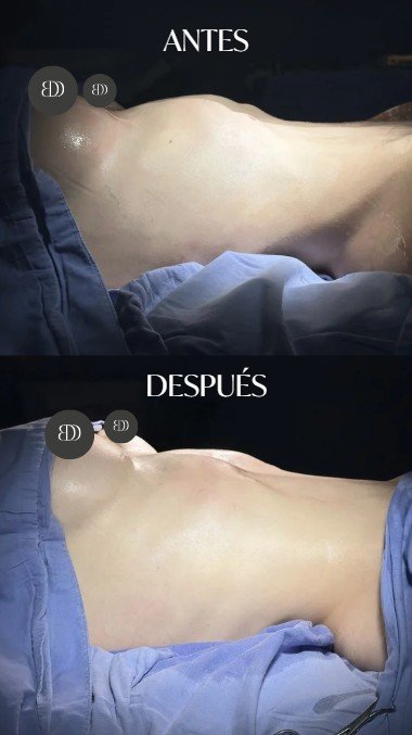 ¿Cómo tener cintura de avispa? - Dr. David Delgado