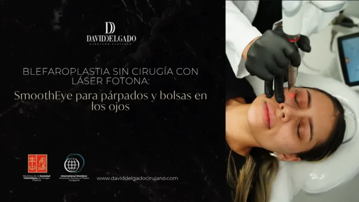 Blefaroplastia sin cirugía con láser fotona - Dr. David Delgado - Medellín, Colombia