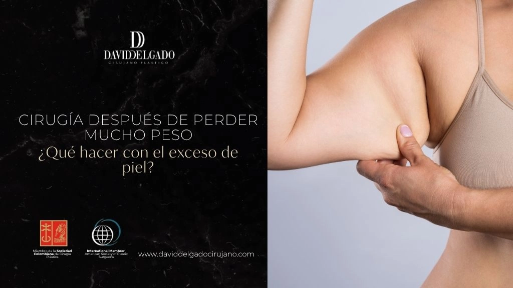 Cirugía después de perder mucho peso Qué hacer con el exceso de piel - Dr David Delgado