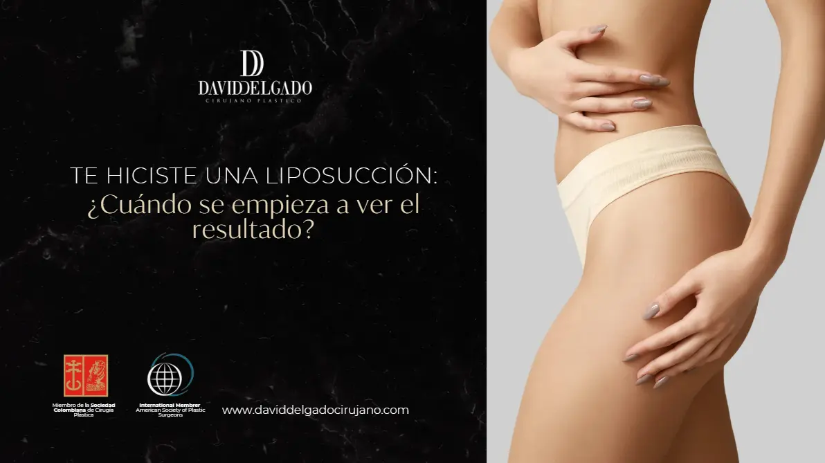 Cuando se ven los resultados de una liposucción- Dr. David Delgado- Cirujano plástico en Medellín