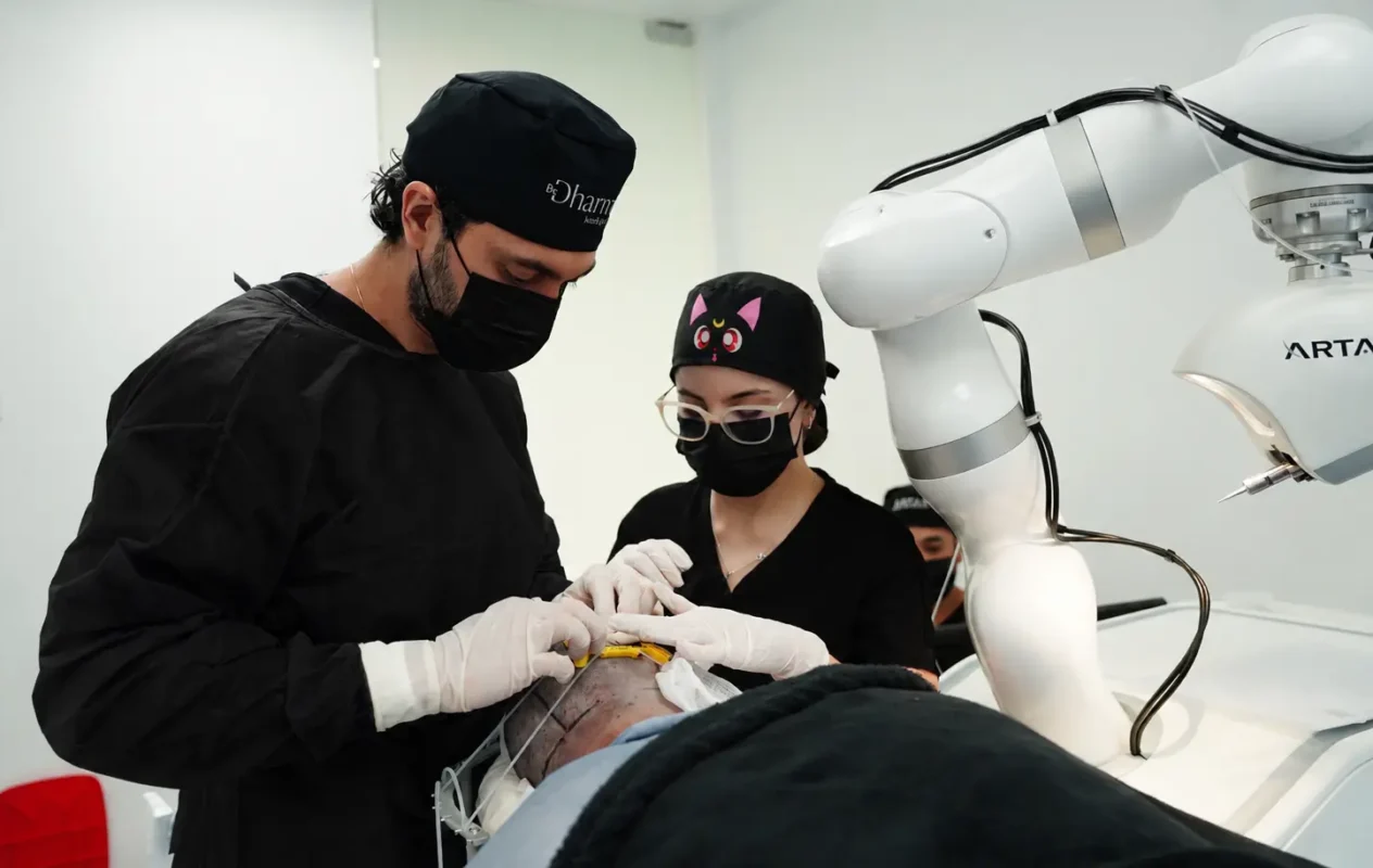 Implante capilar con ARTAS paso 3 - Dr. David Delgado - Be Dharma Hair - Medellín, Colombia