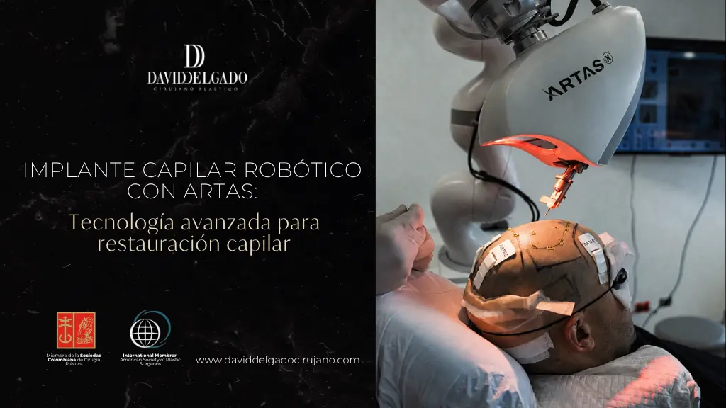 Implante capilar robotico con ARTAS - Dr. David Delgado - Be Dharma Hair - Medellín, Colombia
