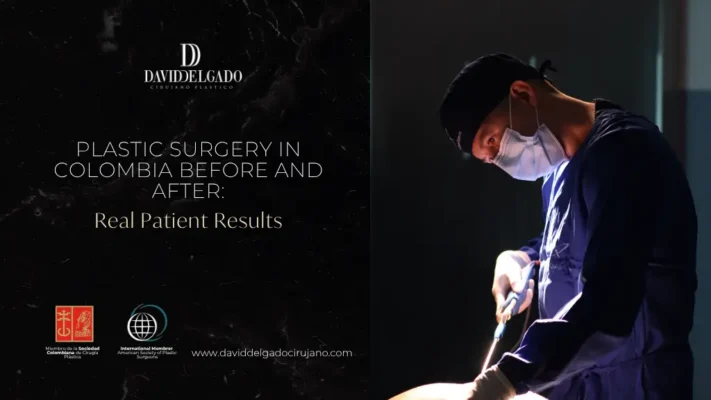 Plastic Surgery in Colombia Before and After - Dr. David Delgado - Medellin