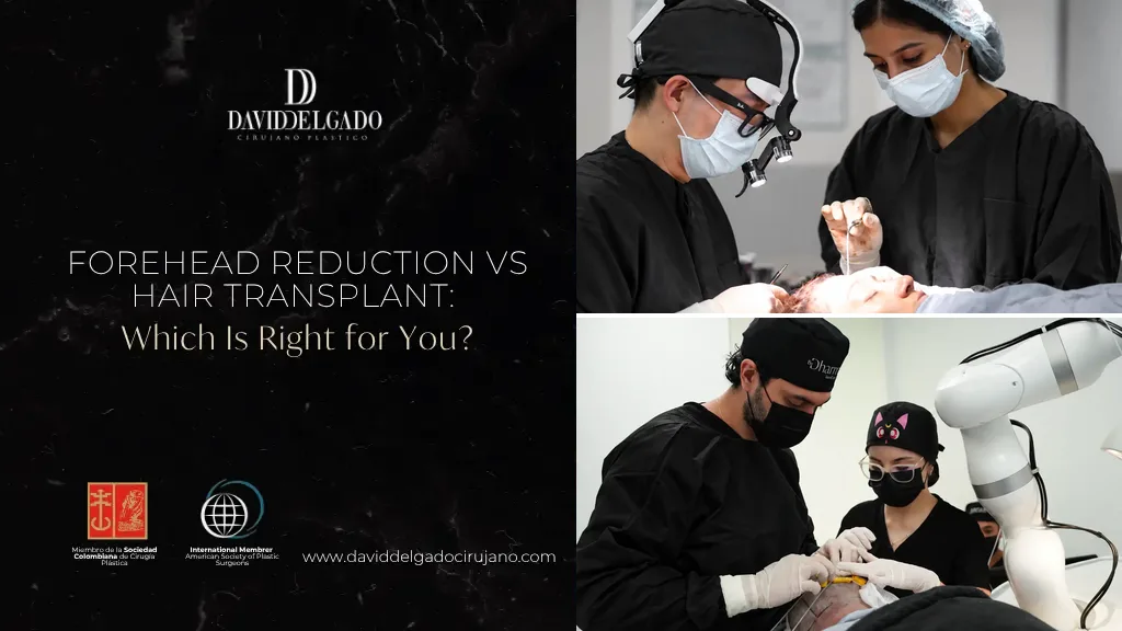 Forehead Reduction vs Hair Transplant - Dr. David Delgado - Medellin, Colombia